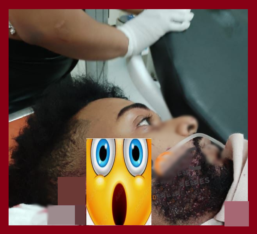 Un boquete en la cara