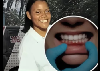 SALEN DETALLES IN INQUIETANTES